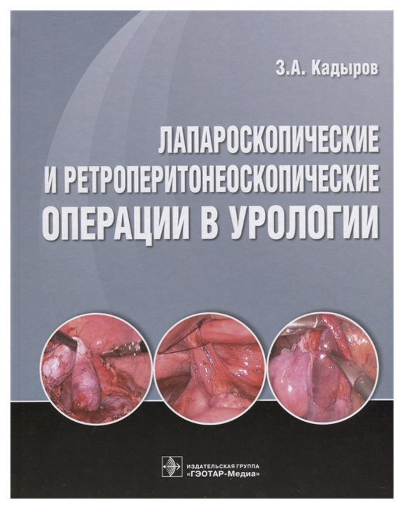фото Книга лапароскопические и ретроперитонеоскопические операции в урологии гэотар-медиа