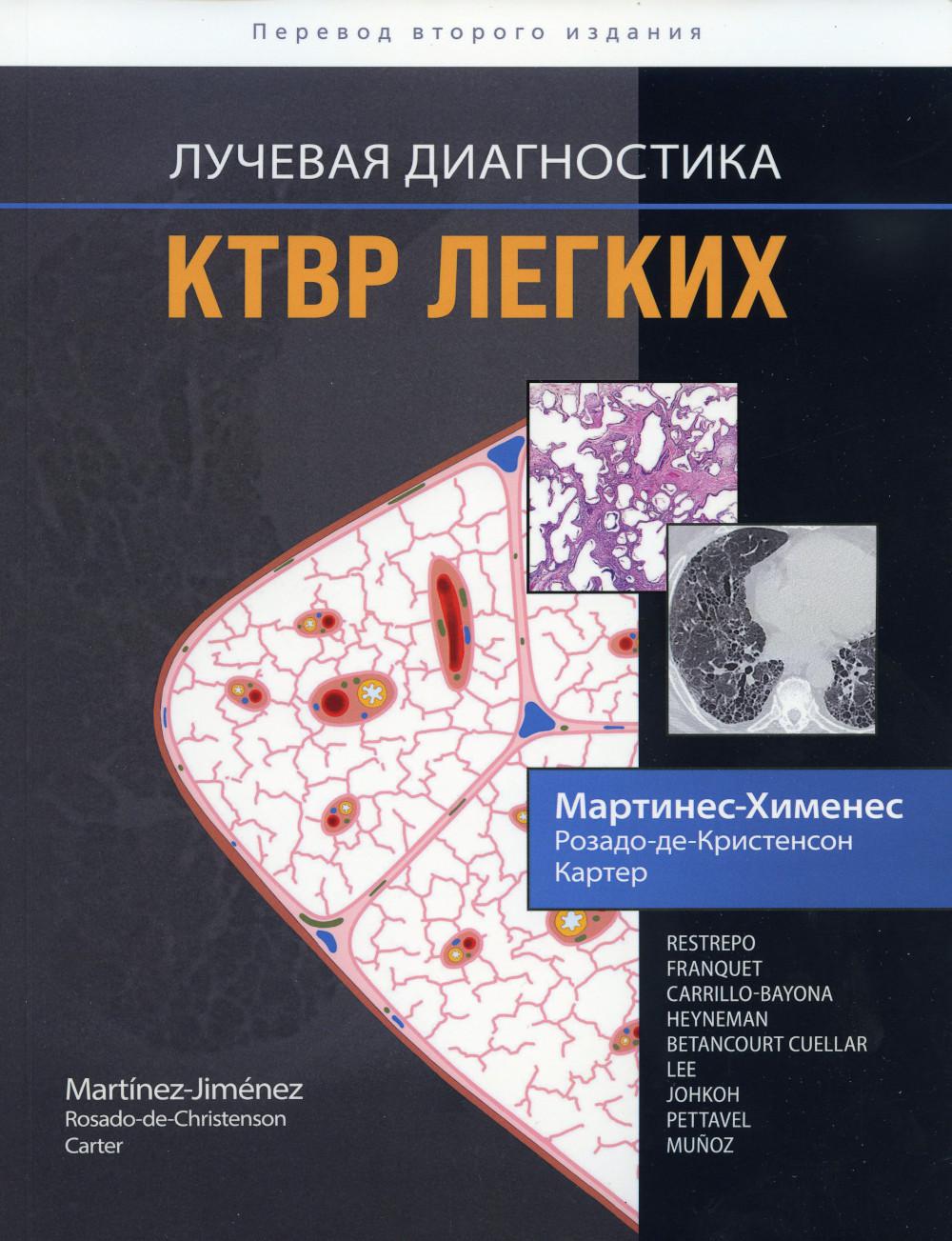 

Лучевая диагностика. КТВР легких