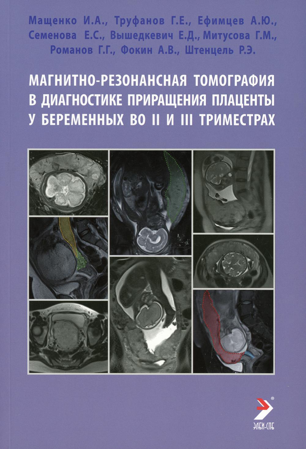 фото Книга магнитно-резонансная томография в диагностике приращения плаценты у беременных во... элби