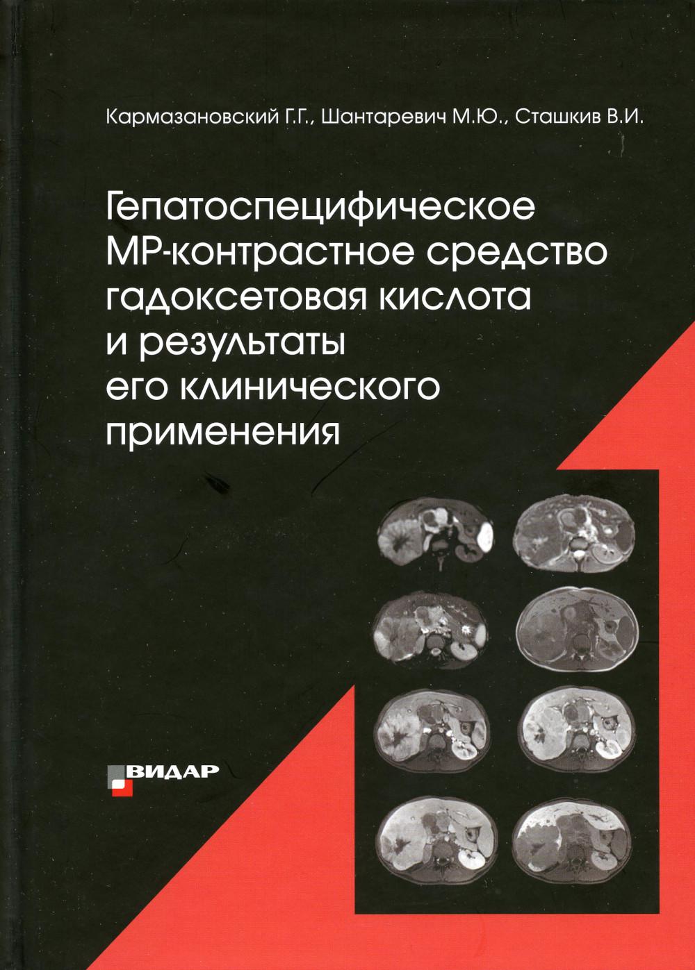 фото Книга гепатоспецифическое мр-контрастное средство "гадоксетовая кислота" и результаты е... видар-м