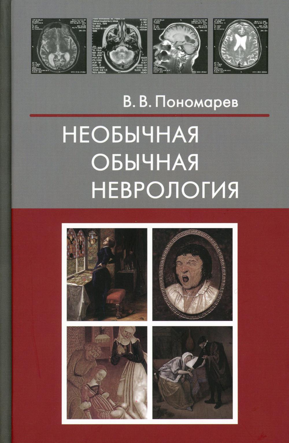 

Необычная обычная неврология