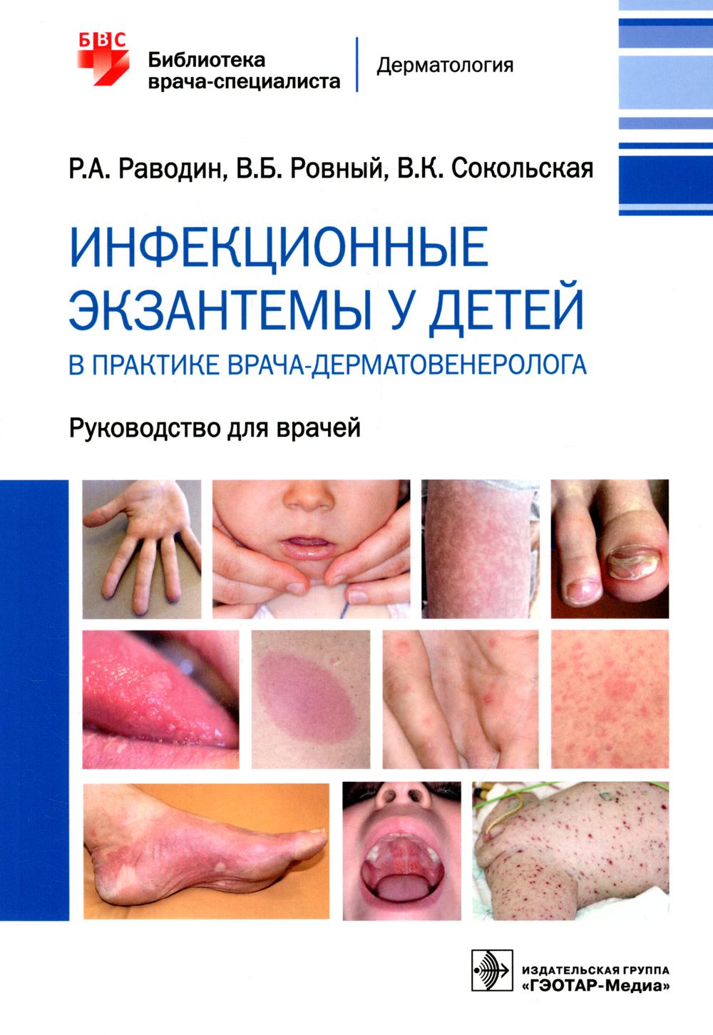 

Инфекционные экзантемы у детей в практике врача-дерматовенеролога