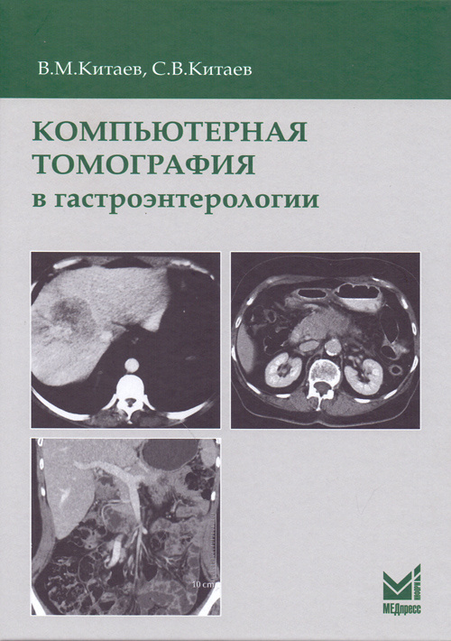 

Книга Компьютерная томография в гастроэнтерологии. Руководство