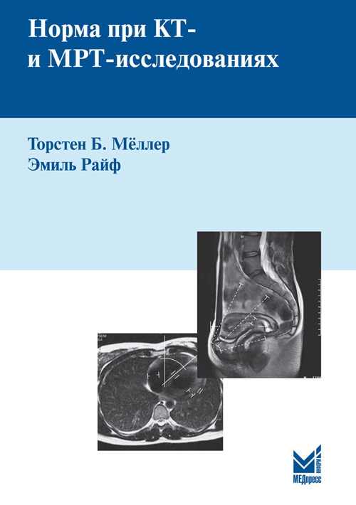 фото Книга норма при кт- и мрт-исследованиях медпресс-информ