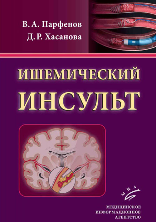 

Книга Ишемический инсульт