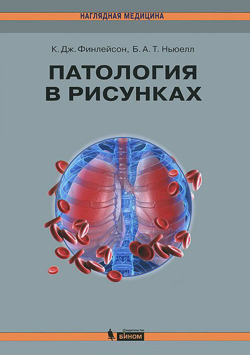 фото Книга патология в рисунках бином. лаборатория знаний