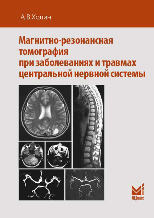 

Магнитно-резонансная томография при заболеваниях и травмах центральной нервной си...