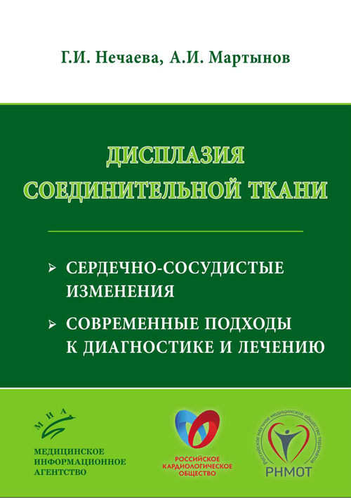 фото Книга дисплазия соединительной ткани: сердечно-сосудистые изменения, современные подхо... миа (медицинское информационное агентство)