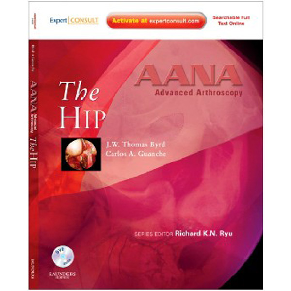 

AANA Advanced Arthroscopy: The Hip / J.W.Thomas Byrd, Carlos A. Guanche