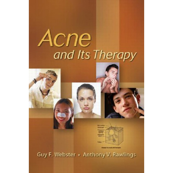 

Acne And Its Therapy / Webster Guy F