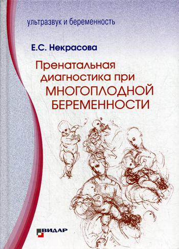 фото Книга пренатальная диагностика при многоплодной беременности видар-м