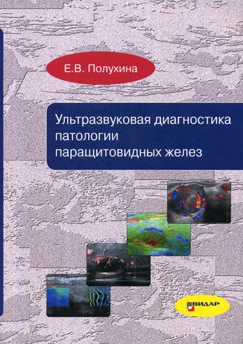 фото Книга ультразвуковая диагностика патологии паращитовидных желез видар-м