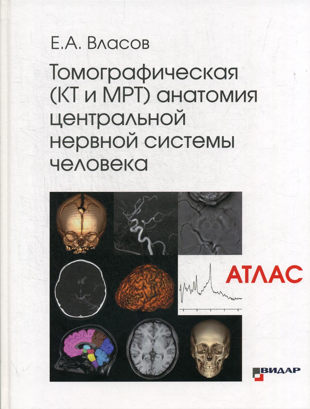 

Томографическая КТ и МРТ анатомия центральной нервной системы человека Атлас