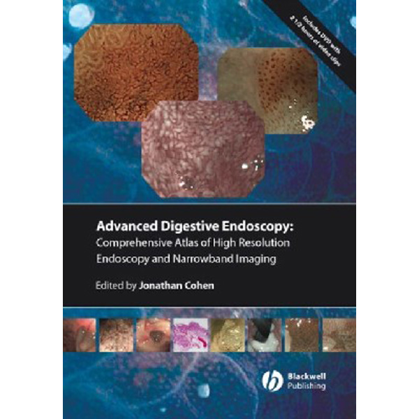 

Advanced Digestive Endoscopy - Comprehensive Atlas of High Resolution Endoscopy ...