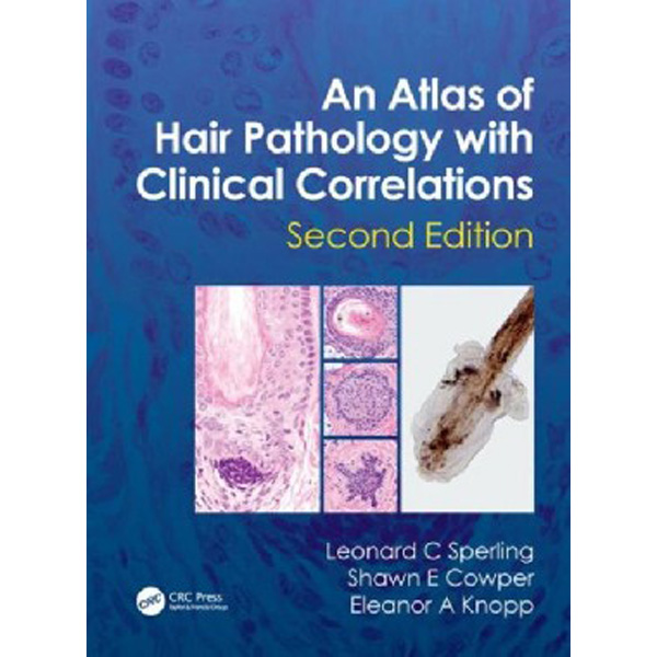 

An Atlas of Hair Pathology with Clinical Correlations, 2 Ed. / Leonard C. Sperling