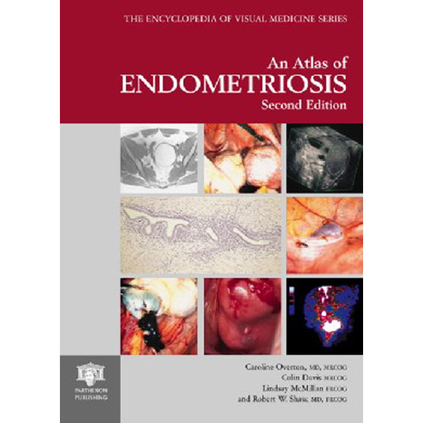 

Atlas Of Endometriosis / Overton Caroline