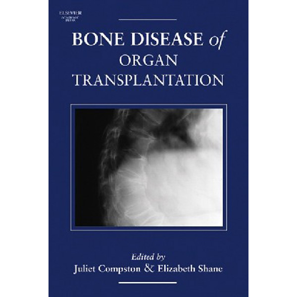 

Bone Disease of Organ Transplantation, / Juliet Compston