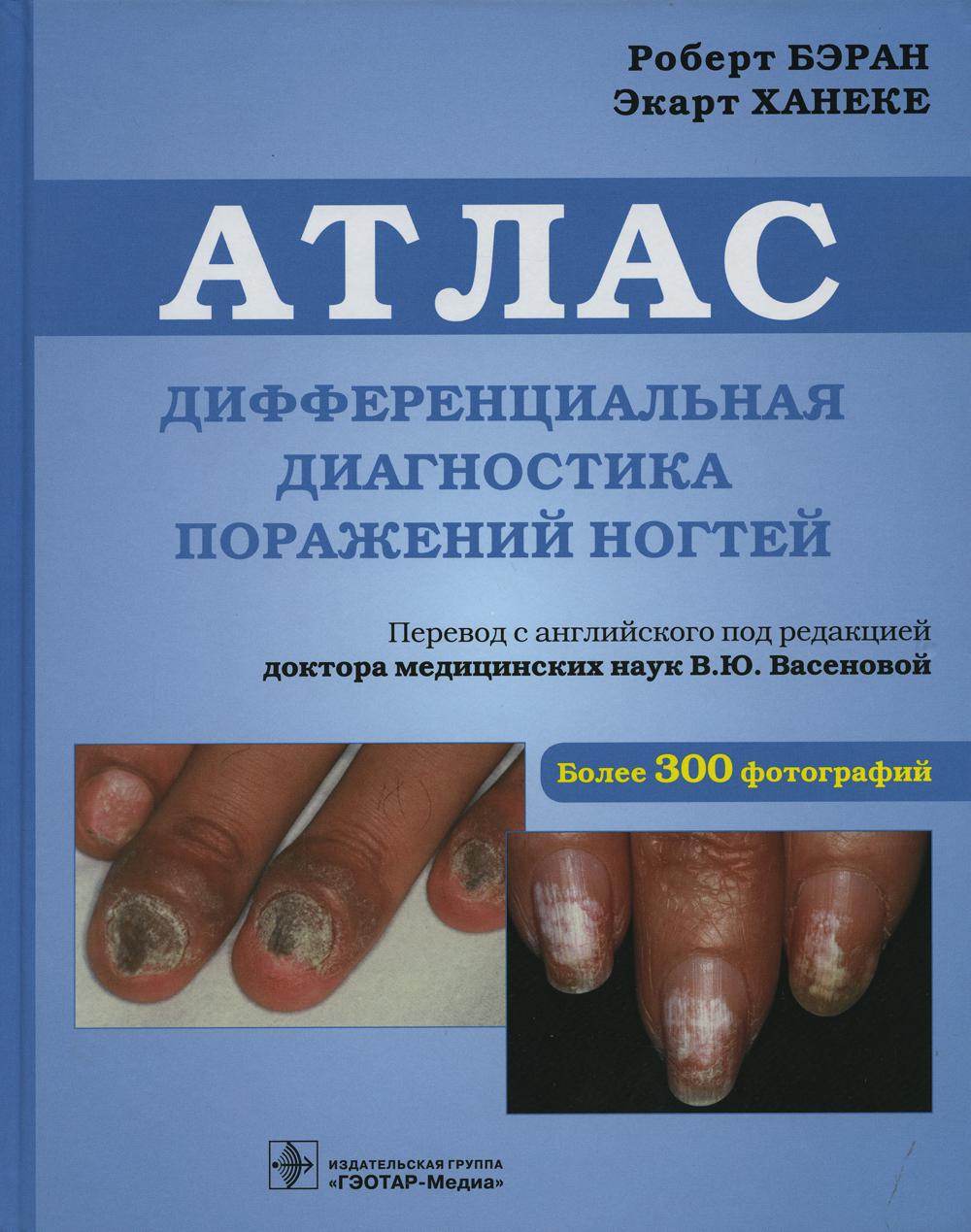 

Дифференциальная диагностика поражений ногтей