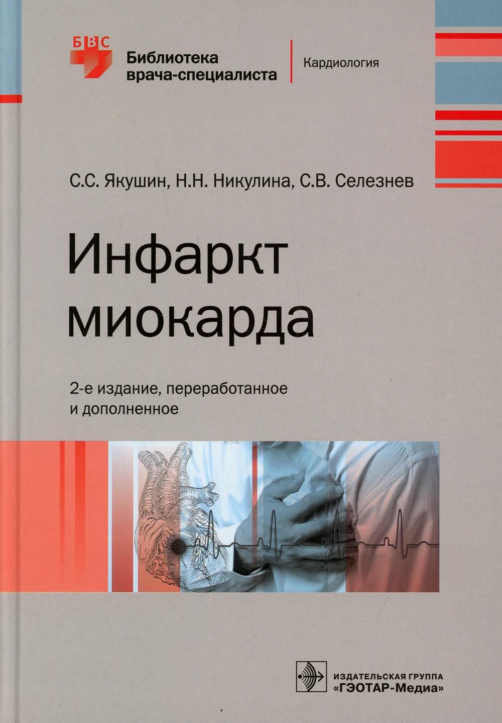 

Инфаркт миокарда