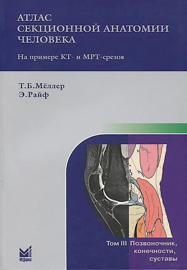 фото Атлас секционной анатомии. т.3. позвоночник, конечности, суставы / мёллер т.б. медпресс