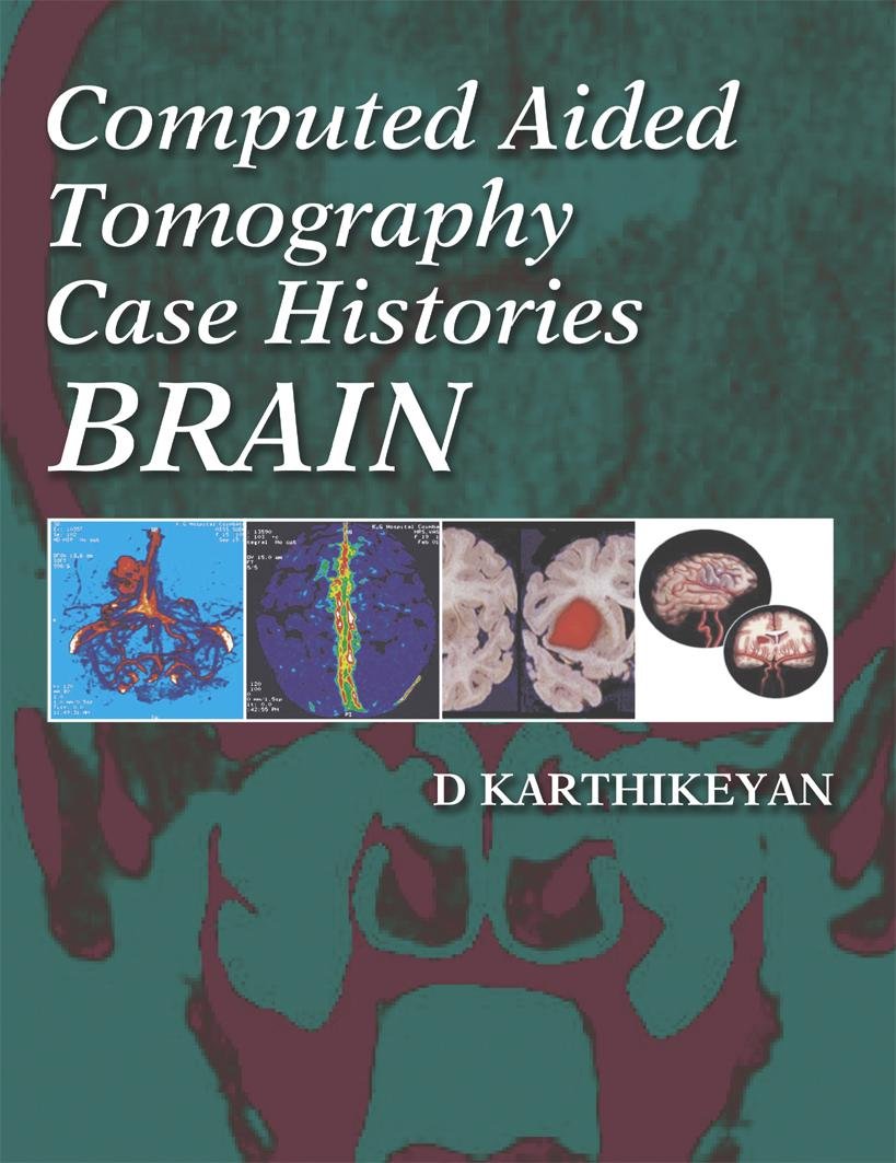 

Computed Aided Tomography Case Histories Brain / Kartikeyan