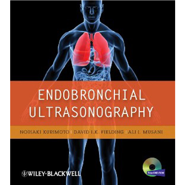 

Endobronchial Ultrasonography / Kurimoto