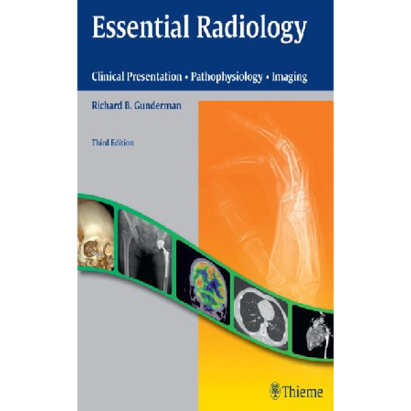 

Essential Radiology: Clinical Presentation · Pathophysiology · Imaging. / Gunderm...