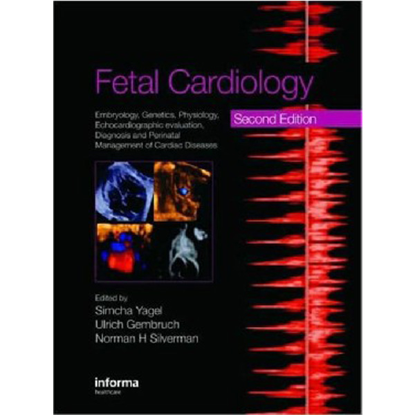 

Fetal Cardiology: Embryology, Genetics, Physiology, Echocardiography Evaluation, Diagno...