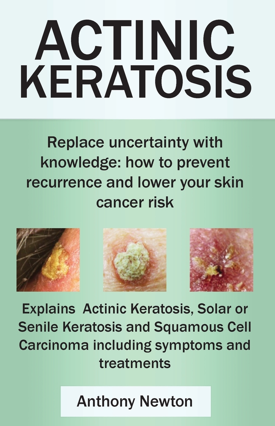 

Actinic Keratosis. Replace the Fear and Uncertainty with Knowledge