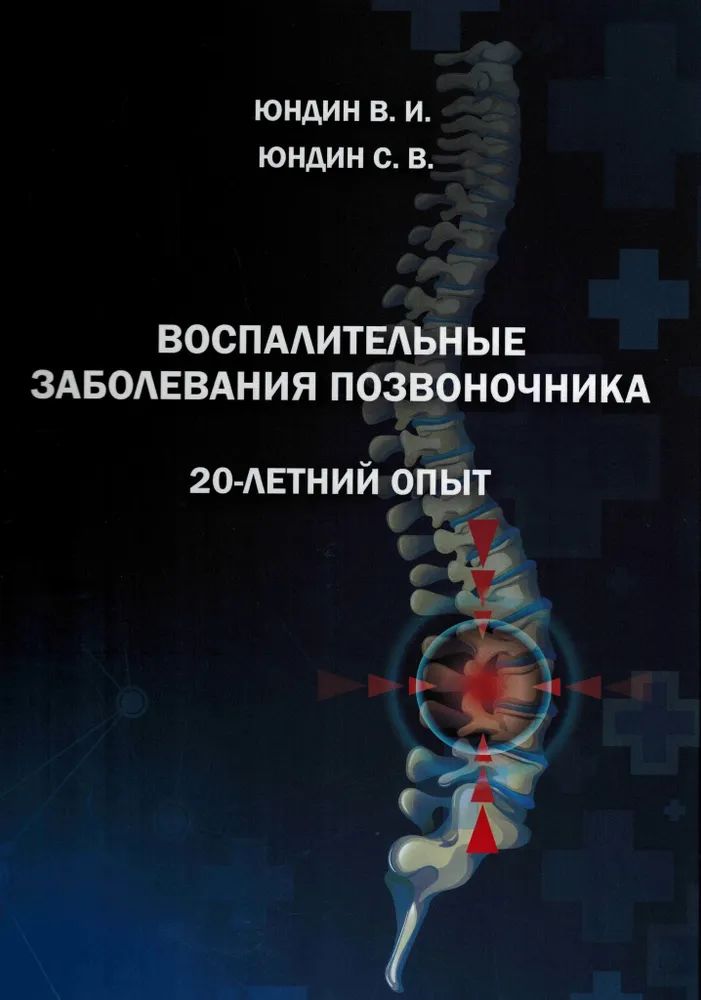 

Воспалительные заболевания позвоночника. 20-летний опыт. / Юндин В.И.