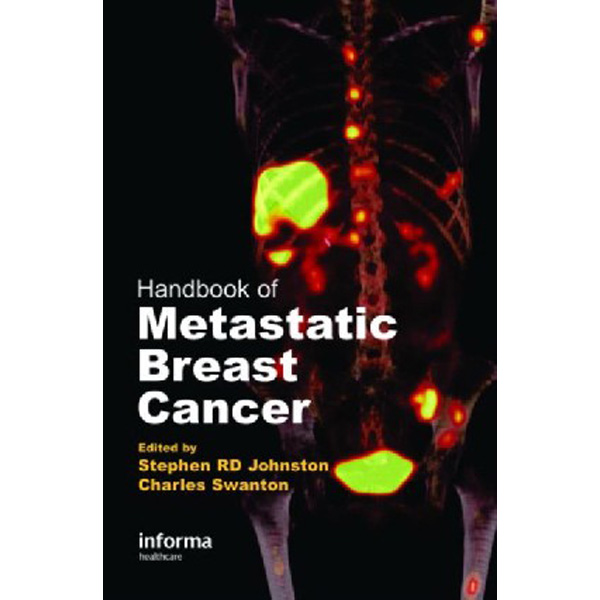 

Handbook Of Metastatic Breast Cancer / Johnston