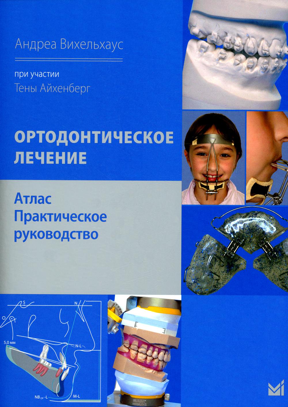 

Ортодонтическое лечение