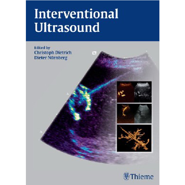 

Interventional Ultrasound: A Practical Guide and Atlas / Christoph Frank Dietrich