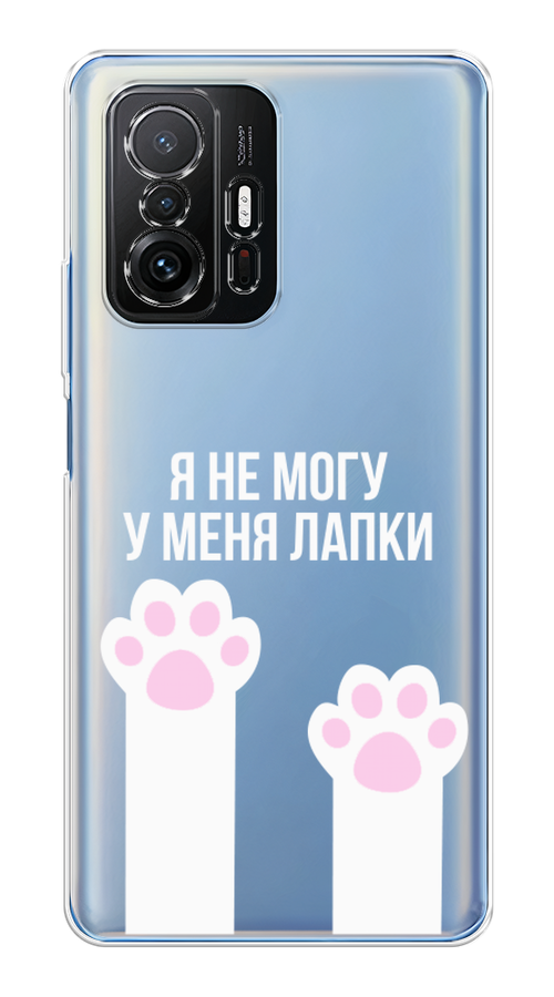 

Чехол на Xiaomi Mi A1/5X "У меня лапки", Белый;розовый, 32350-6