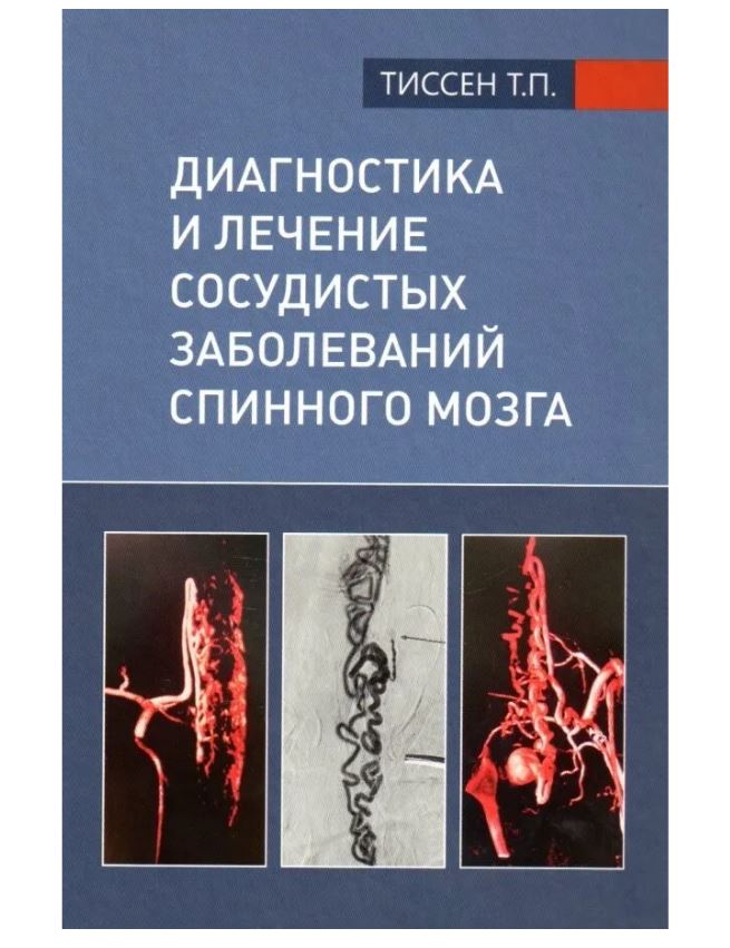 

Диагностика и лечение сосудистых заболеваний спинного мозга / Тиссен Т.П.