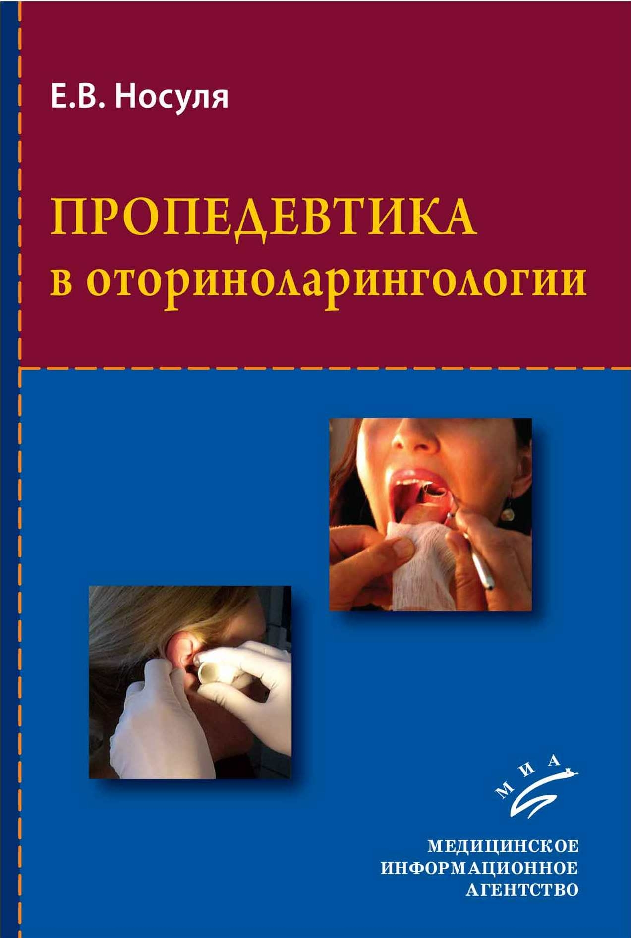 

Книга Пропедевтика в оториноларингологии: Учебное пособие (с иллюстрациями) / Носуля Е.В