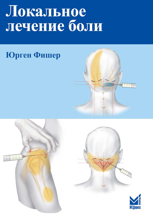 фото Книга локальное лечение боли медпресс-информ