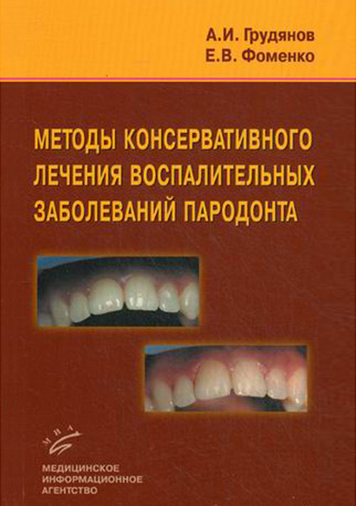 

Книга Методы консервативного лечения воспалительных заболеваний пародонта