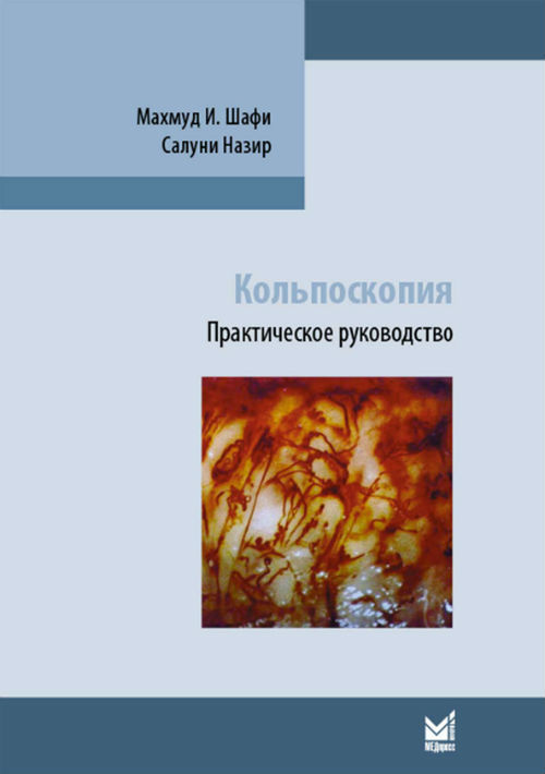

Кольпоскопия. Практическое руководство