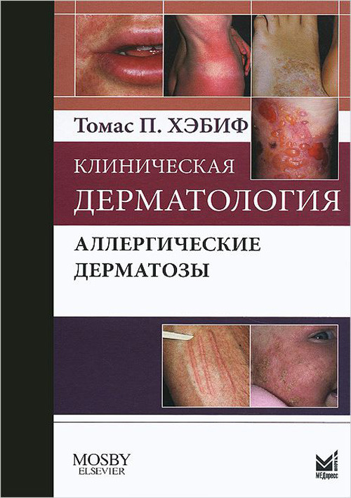 

Клиническая дерматология. Аллергические дерматозы