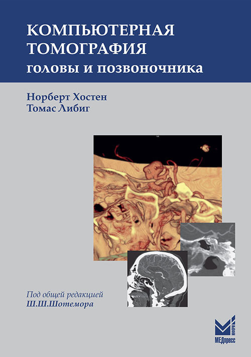 

Компьютерная томография головы и позвоночника