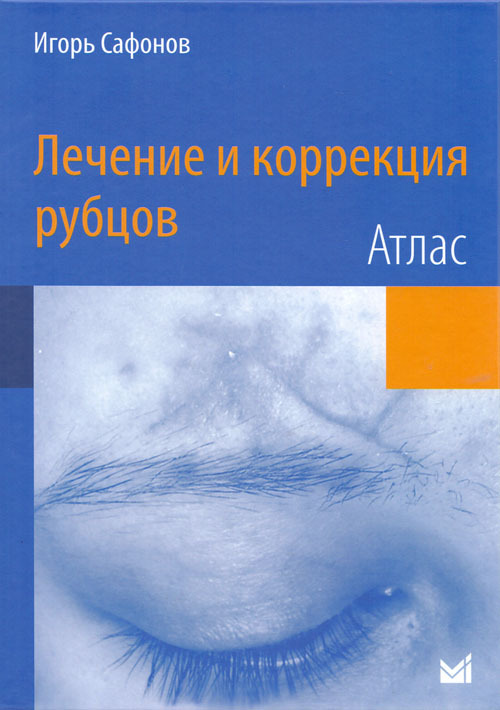 

Лечение и коррекция рубцов. Атлас