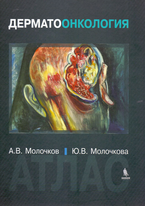 

Дерматоонкология. Атлас