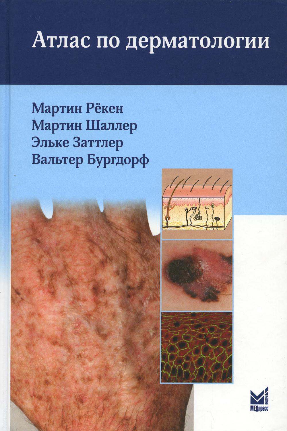   СберМегаМаркет Книга Атлас по дерматологии