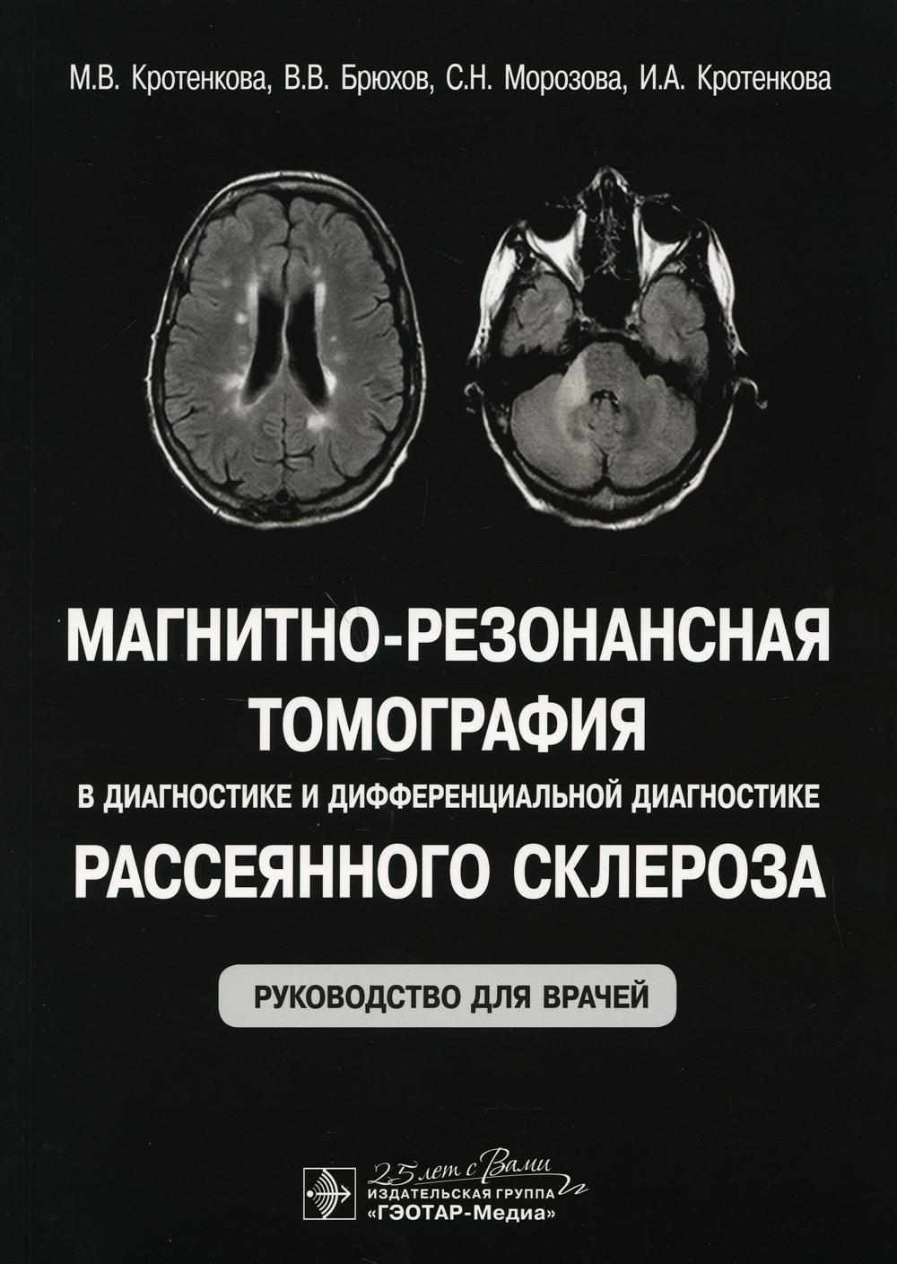 фото Книга магнитно-резонансная томография в диагностике и дифференциальной диагностике рас... гэотар-медиа