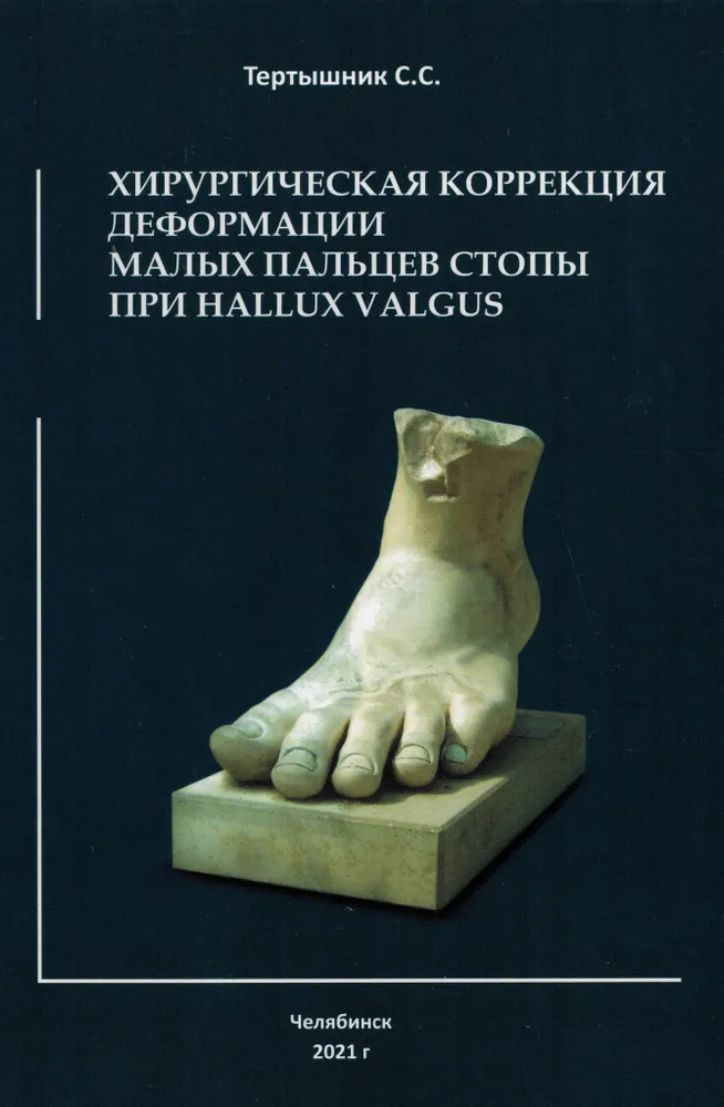 

Хирургическая коррекция деформации малых пальцев стопы при Hallux Valgus