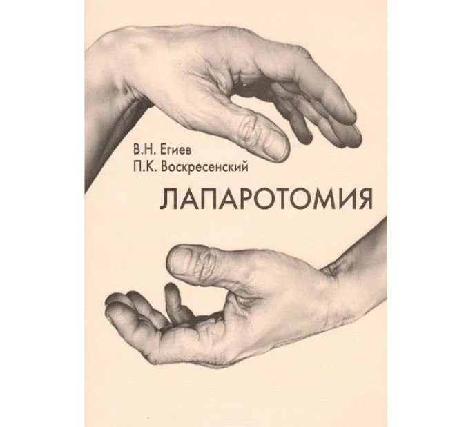 

Лапаротомия