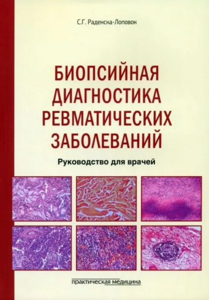 

Биопсийная диагностика ревматических заболеваний. Руководство для врачей