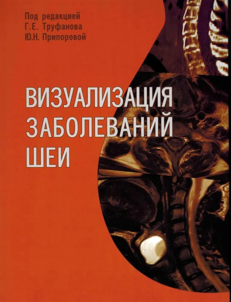 

Визуализация заболеваний шеи