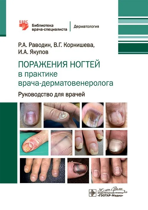 

Поражения ногтей в практике врача-дерматовенеролога : руководство для врачей